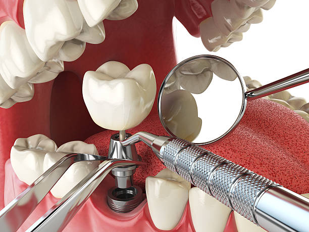 Best Urgent Tooth Repair  in Dry Ridge, KY